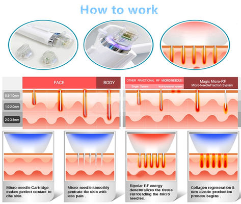 15" TFT LCD Size Diode Laser Hair Removal Machine for Quick and Painless Treatment