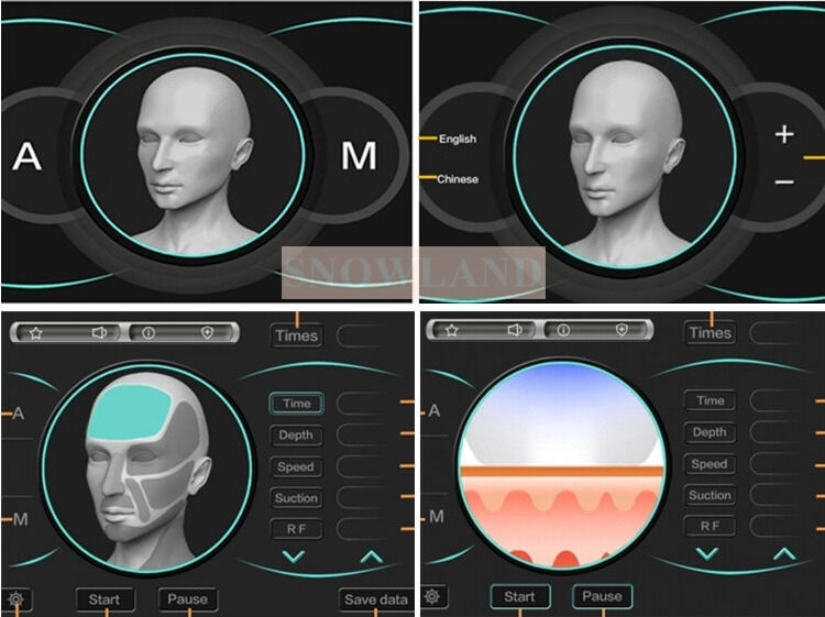 Semicondoctor 808nm Laser Diode Laser Hair Removal Machine With Skin Contact Sensor Ensuring Fast Hair Removal Treatment