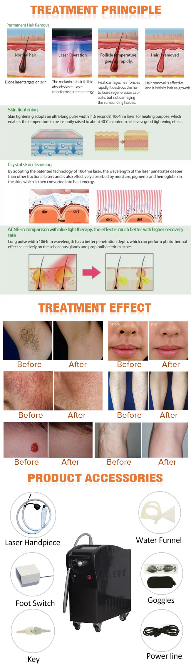 CE 1064 Long Pulsed Machine Laser Epilation Alexandrite Pulsed Dye